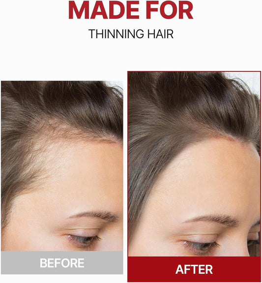 Before and after comparison of thinning hair treatment on a person's scalp.