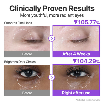 Numbuzin - No.9 NAD+ Retinol Volumetox Eye Cream