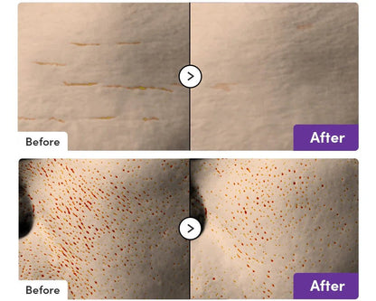 Eqqualberry - Bakuchiol Plumping SerumEqqualberryBarehug