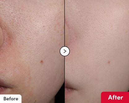 Eqqualberry - Vitamin Illuminating SerumEqqualberryBarehug