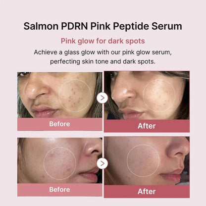 Medicube - PDRN Pink Peptide SerumMedicubeBarehug
