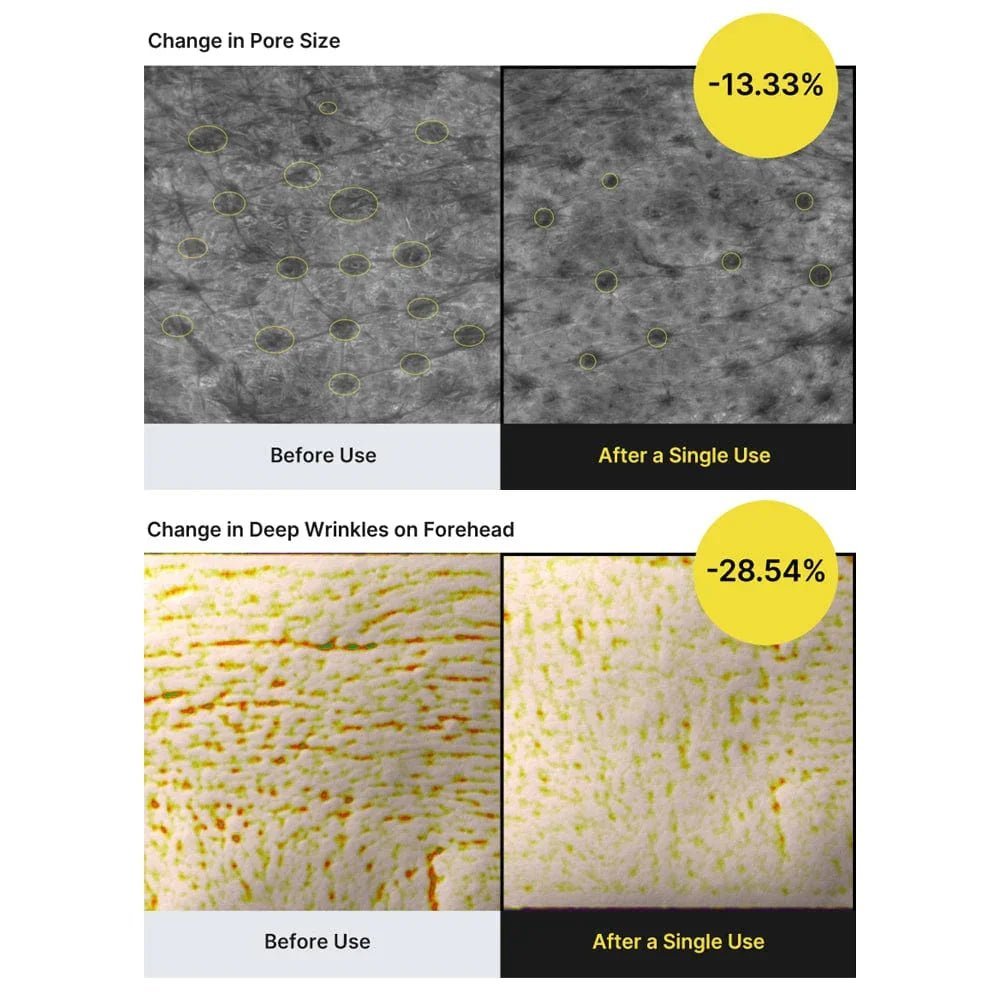 Celimax - Vita A Retinal Shot Tightening Booster (15ml)CelimaxBarehug