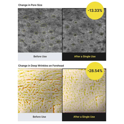 Celimax - Vita A Retinal Shot Tightening Booster (15ml)CelimaxBarehug