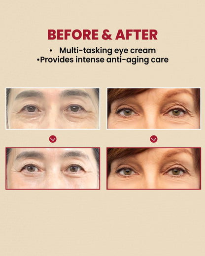 SEOUL 1988 Retinal Eye Cream