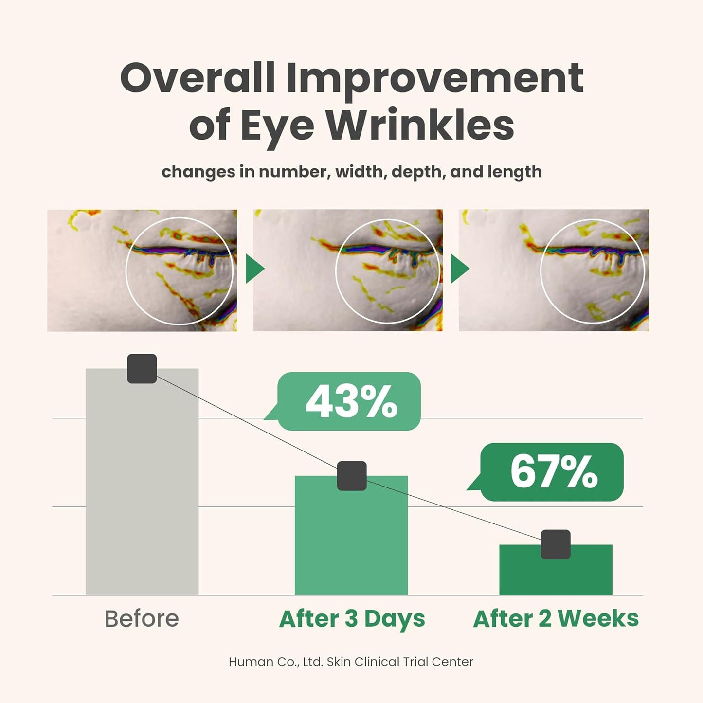 Graph showing the improvement of eye wrinkles with percentages before and after 3 days and 2 weeks.