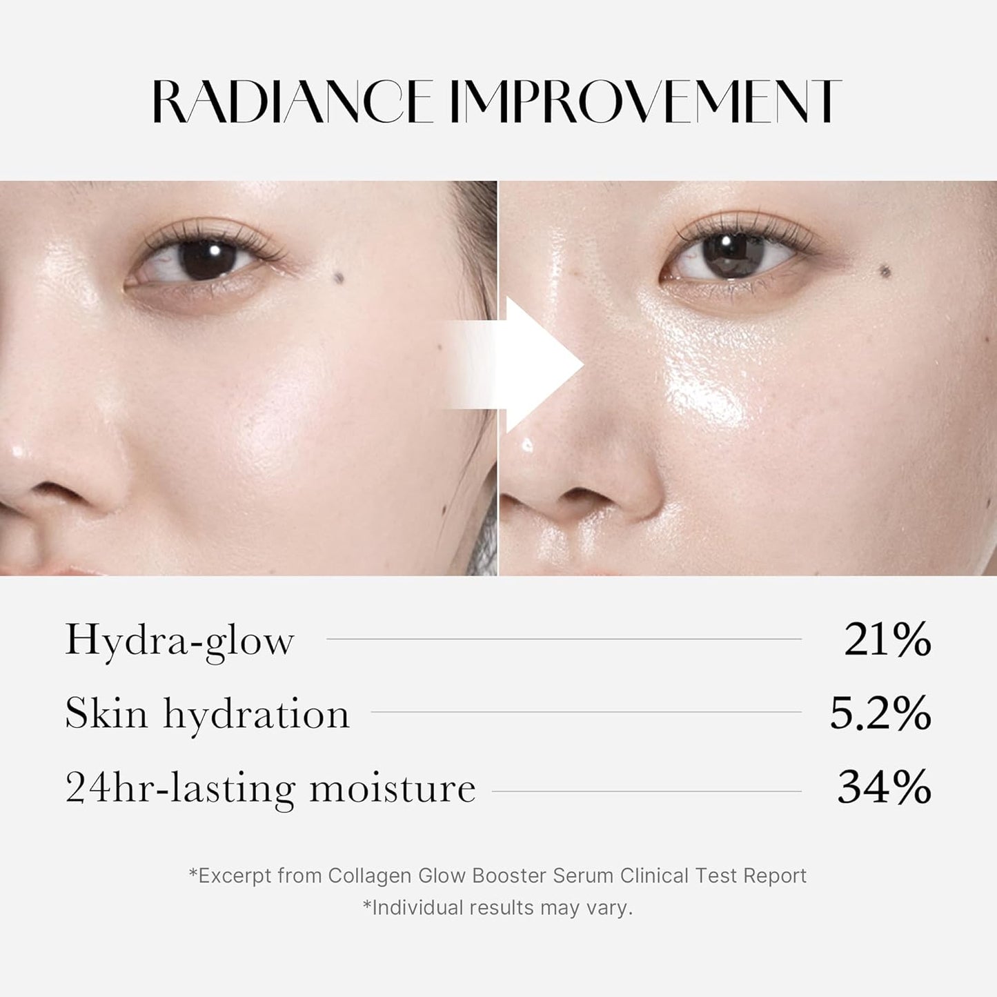 Before and after comparison of a person's face with radiance improvement text and percentages.