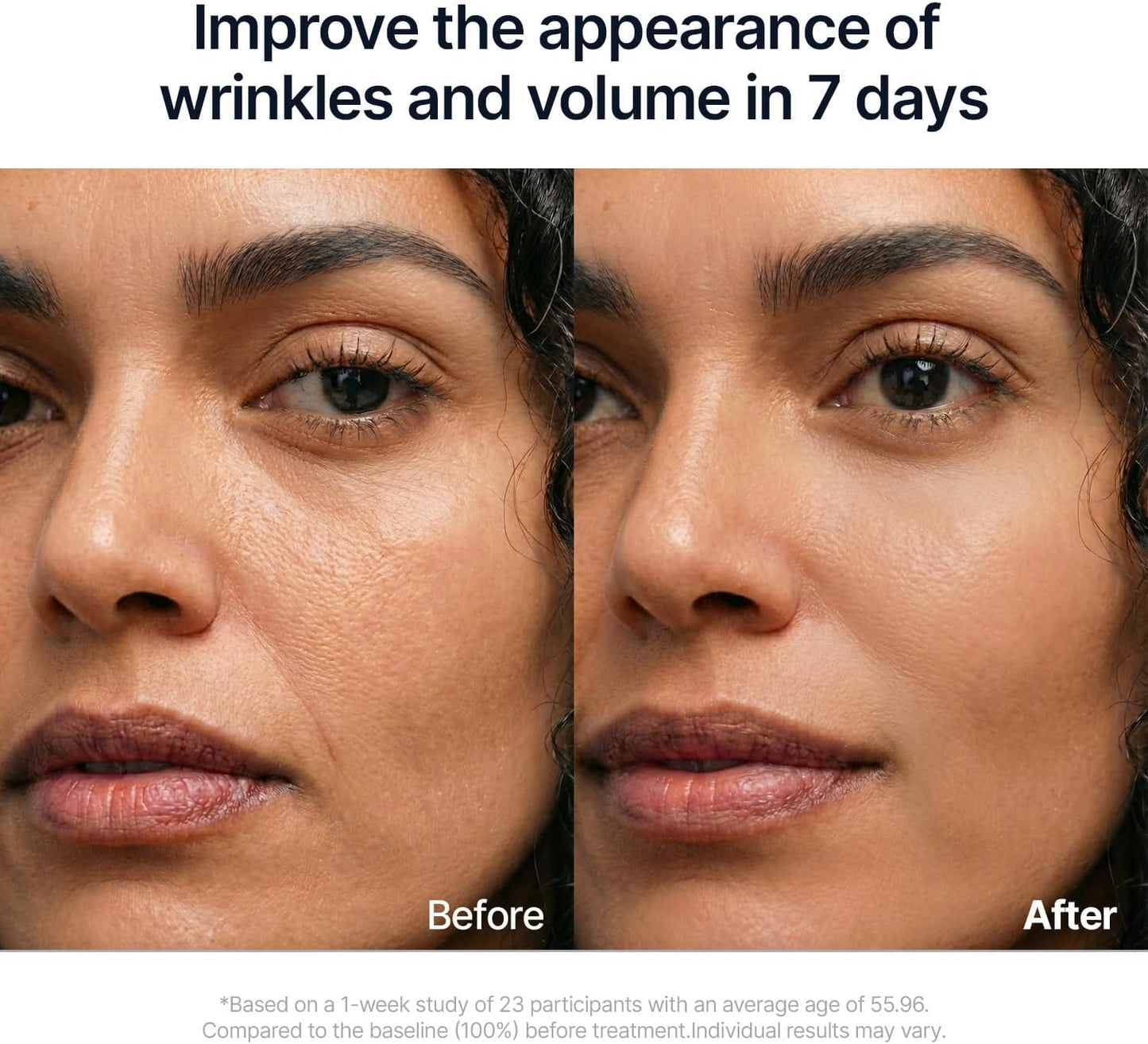 Before and after comparison of a woman's face with text claiming to improve wrinkles and volume in 7 days.