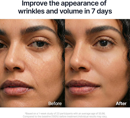 Before and after comparison of a woman's face with text claiming to improve wrinkles and volume in 7 days.