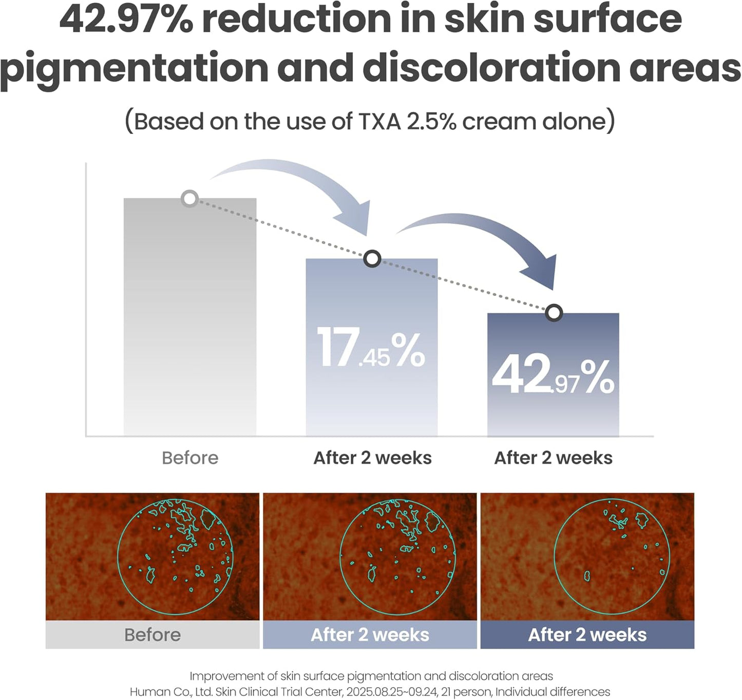 Axis-Y - TXA 2.5% Intensive Brightening Cream