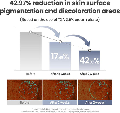Axis-Y - TXA 2.5% Intensive Brightening Cream