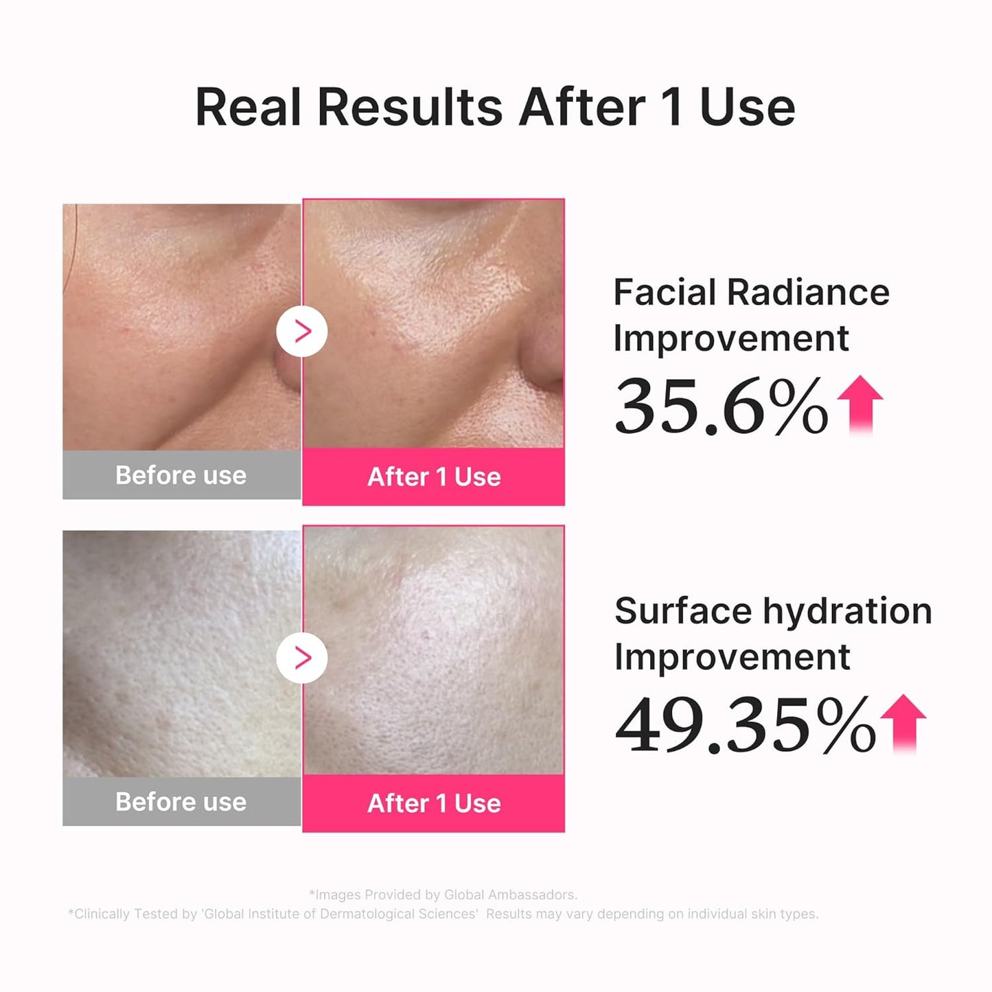 Before and after skin improvement results with facial radiance and surface hydration statistics.
