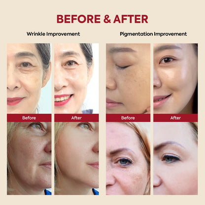 Before and after comparison of wrinkle and pigmentation improvement on faces.