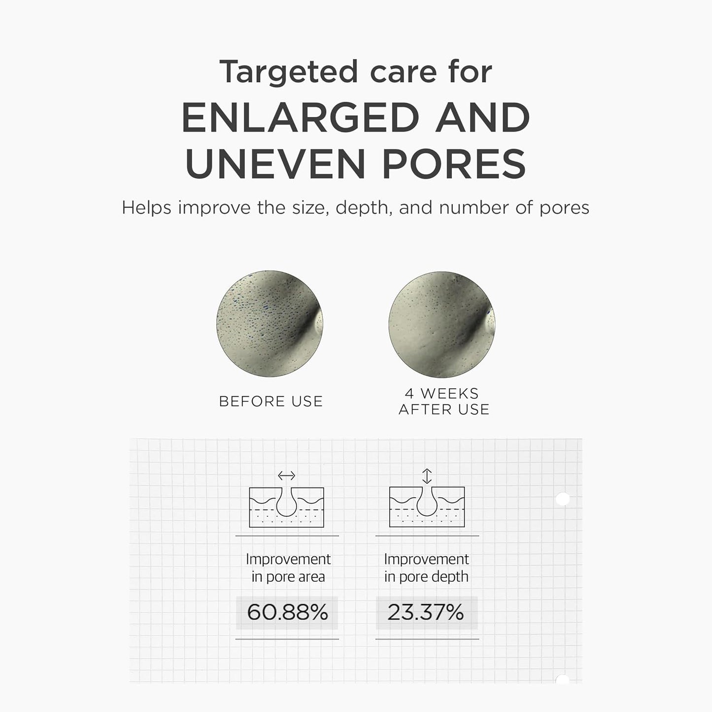 Before and after comparison of pores with text on targeted care for enlarged and uneven pores.