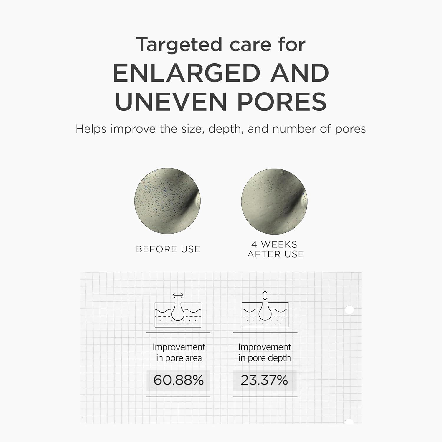 Before and after comparison of pores with text on targeted care for enlarged and uneven pores.