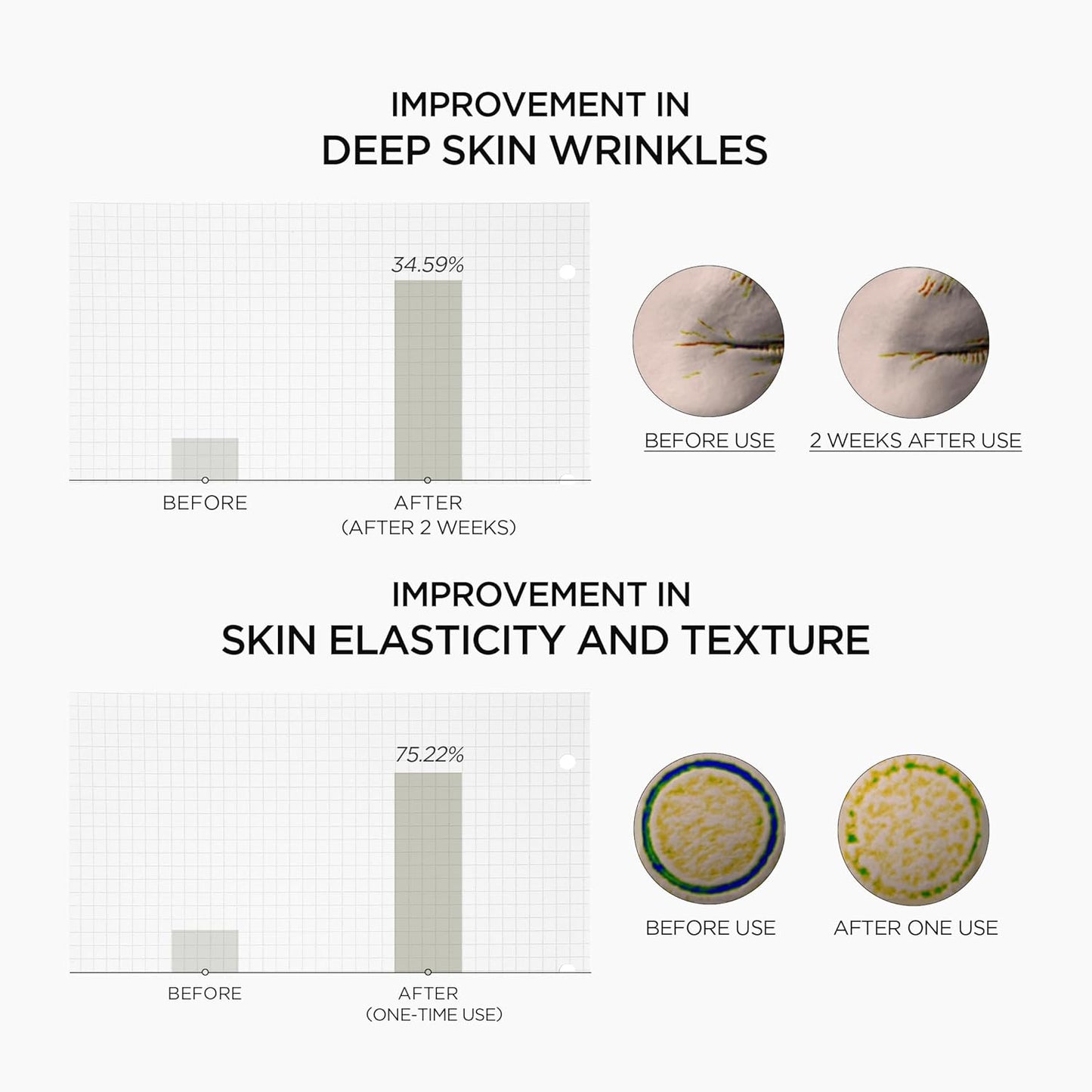 Before and after effects of a skincare product on skin wrinkles and elasticity.