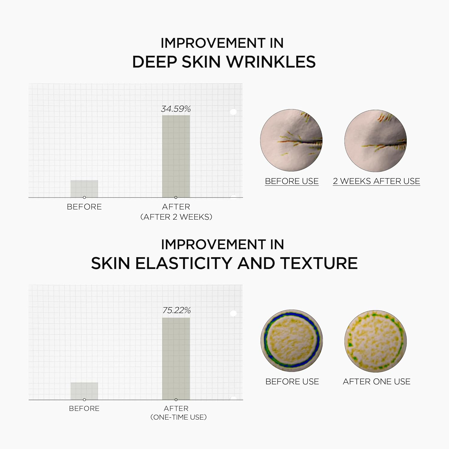 Before and after effects of a skincare product on skin wrinkles and elasticity.