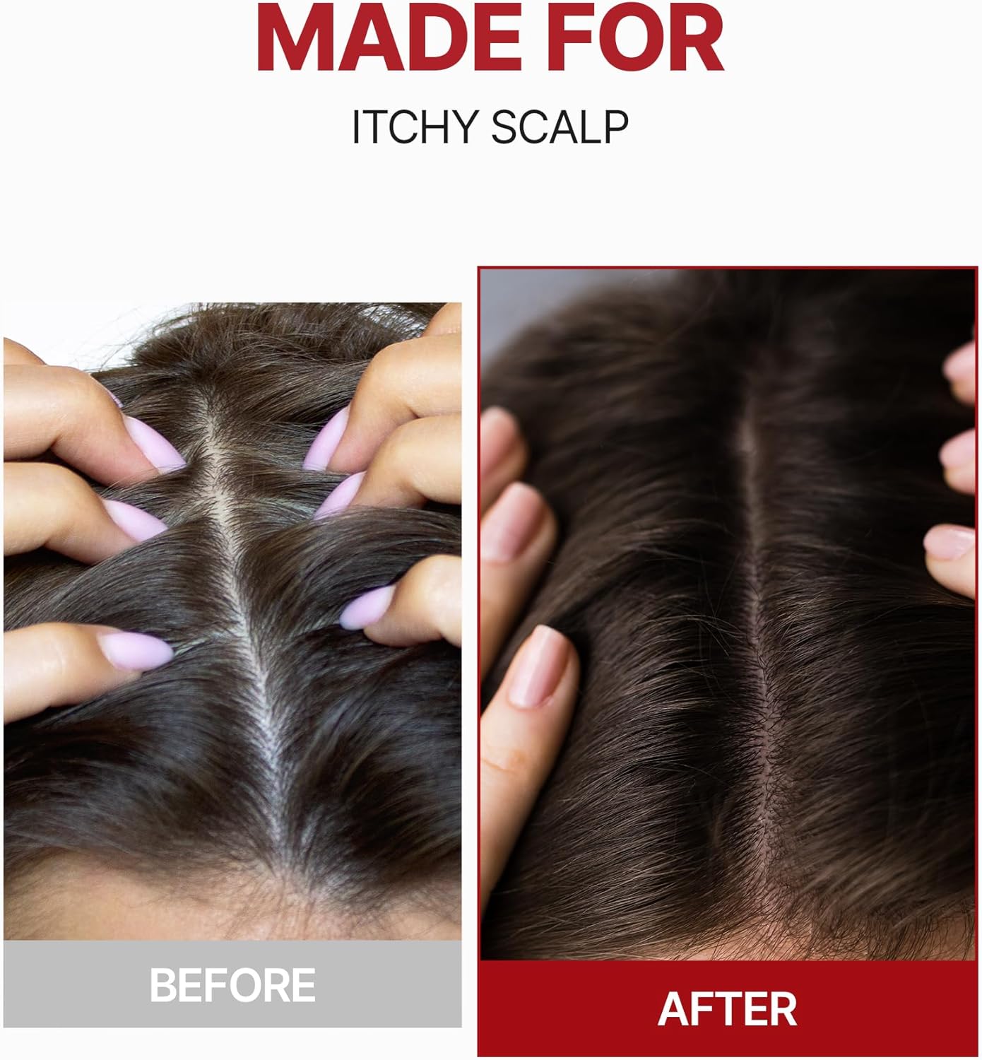 Before and after comparison of itchy scalp with hands touching hair, labeled 'Made for Itchy Scalp'.