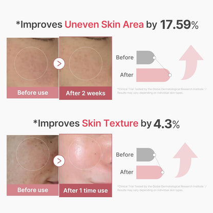 Before and after skin improvement results with text indicating percentage improvements.