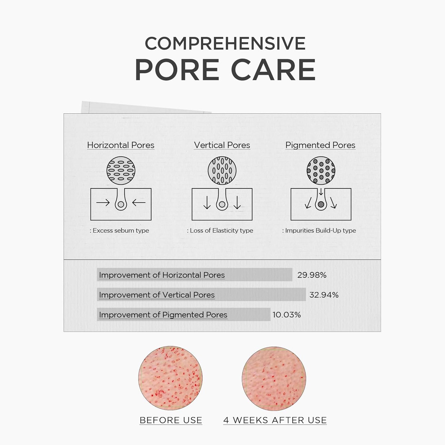Diagram of pore care with before and after effects on skin texture.