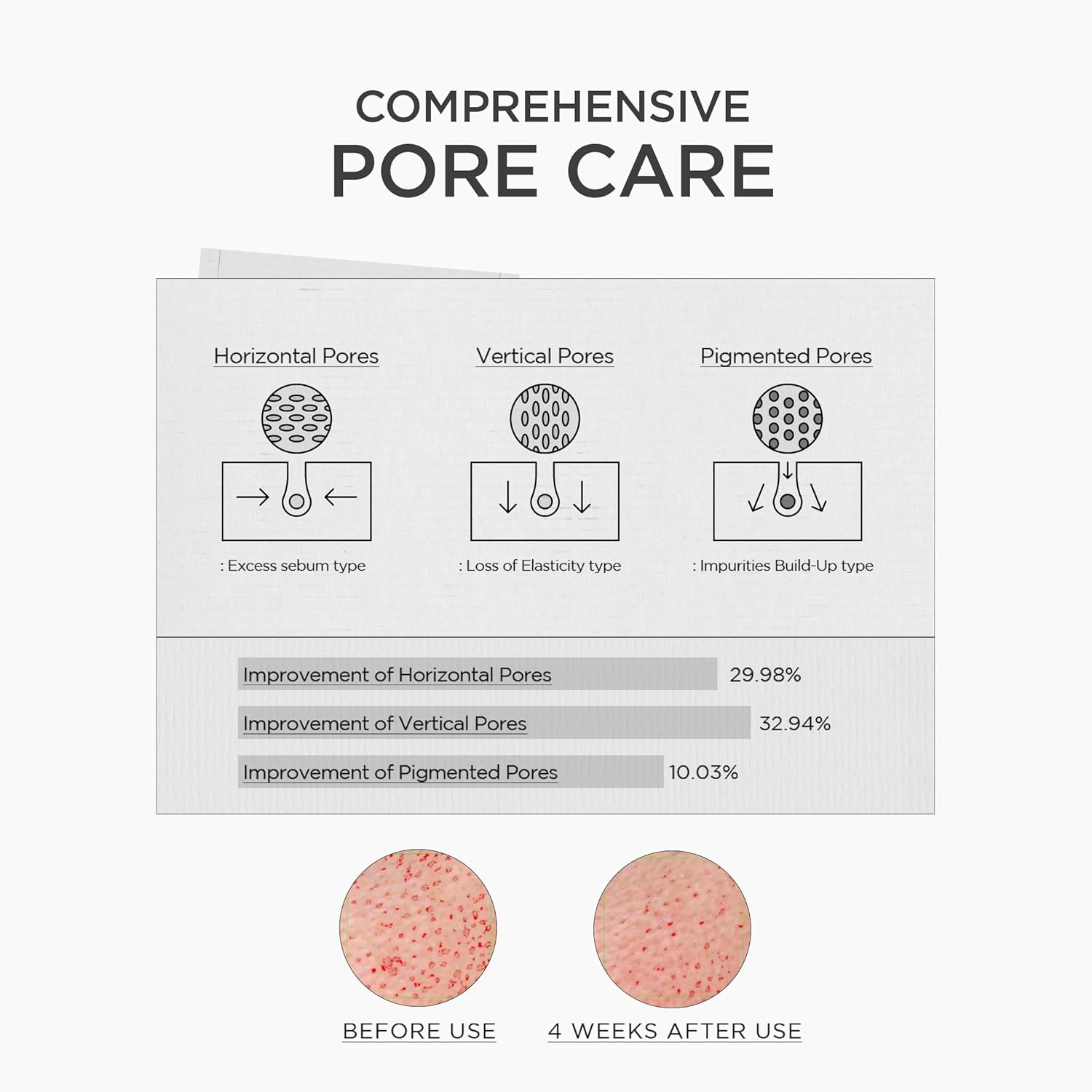 Diagram of pore care with before and after effects on skin texture.