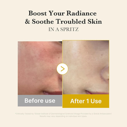 Before and after skin treatment showing improvement with a spritz product.