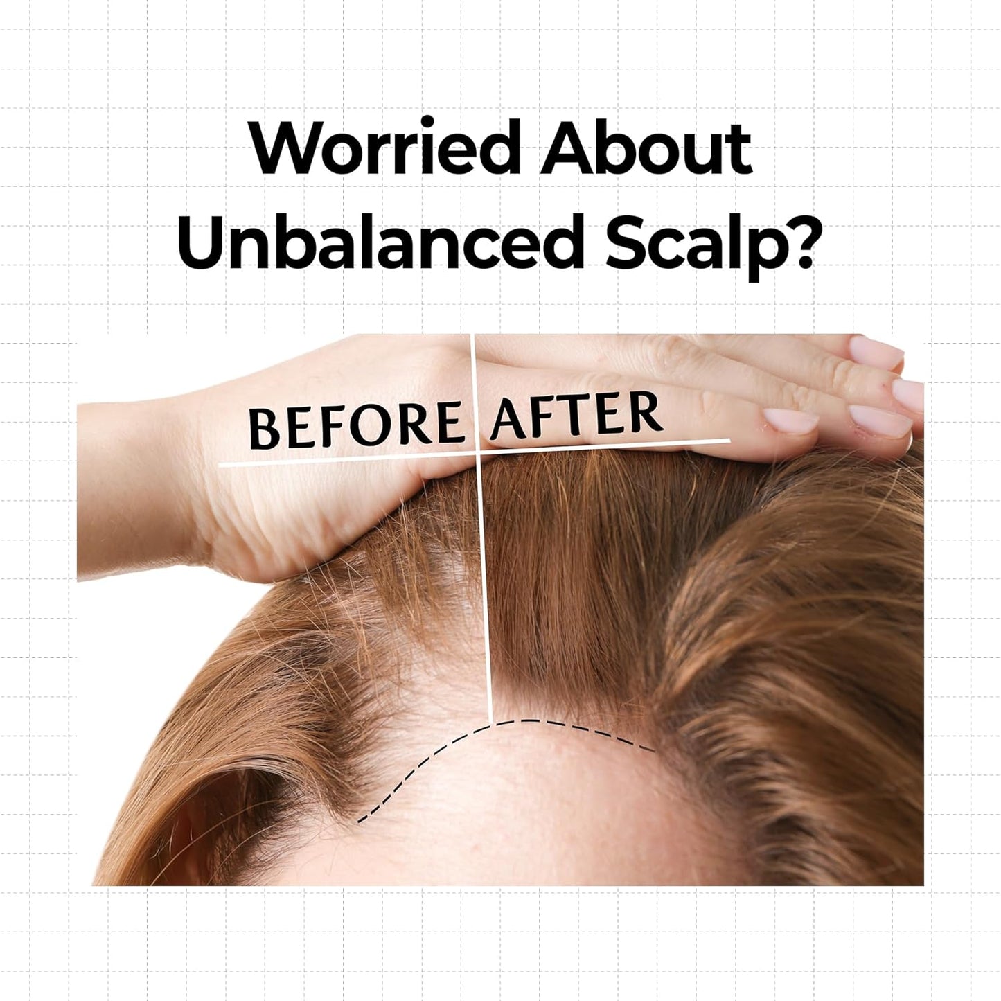 Before and after comparison of a person's scalp with text about unbalanced scalp concerns.