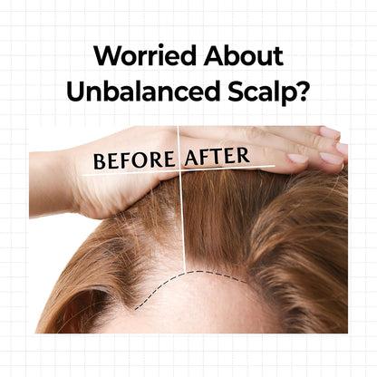 Before and after comparison of a person's scalp with text about unbalanced scalp concerns.