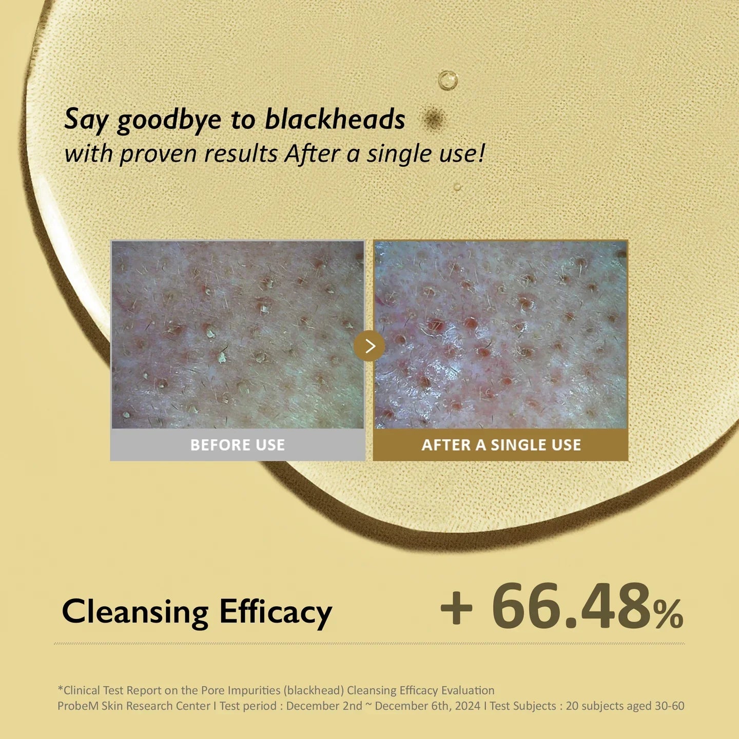 Haruharu Wonder - Black Rice Moisture Deep Cleansing OilHaruharuBarehug