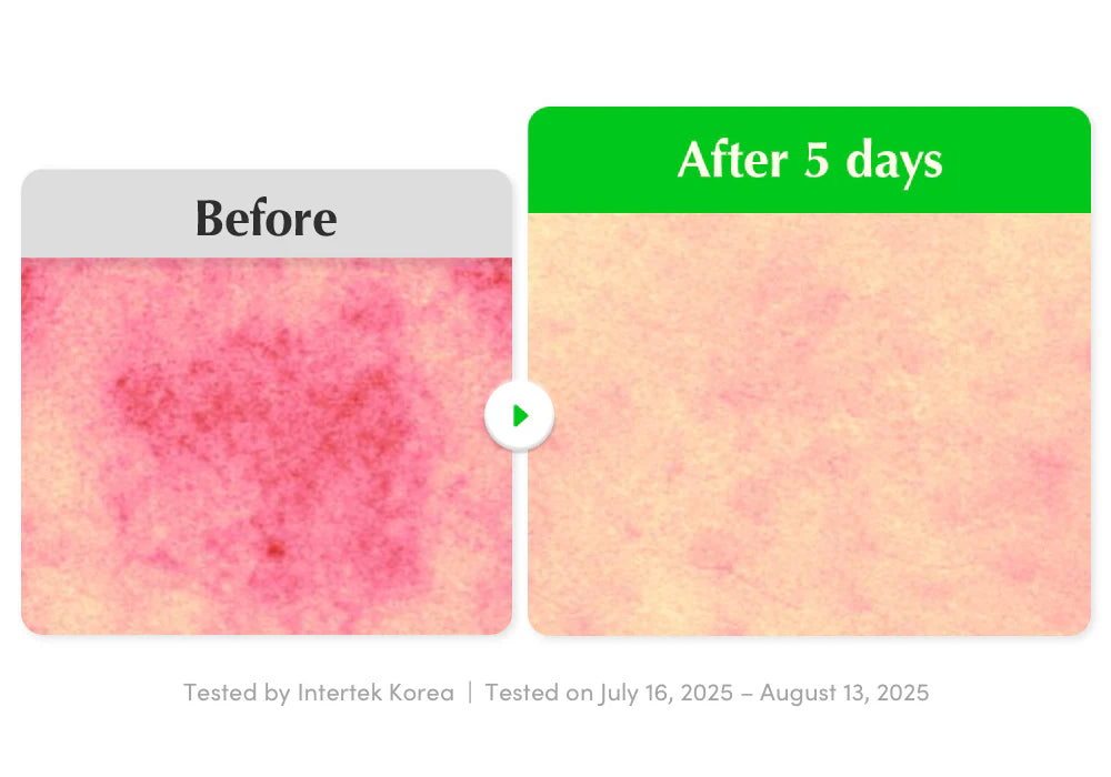 Eqqualberry - Aloe PDRN Calming Serum