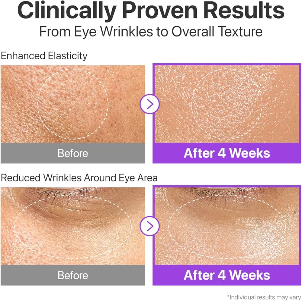 Before and after effects of a skincare treatment on eye wrinkles and skin texture.