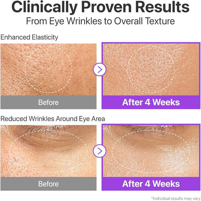 Before and after effects of a skincare treatment on eye wrinkles and skin texture.