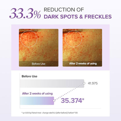Before and after comparison of dark spots and freckles with a 33.3% reduction shown on a purple background.