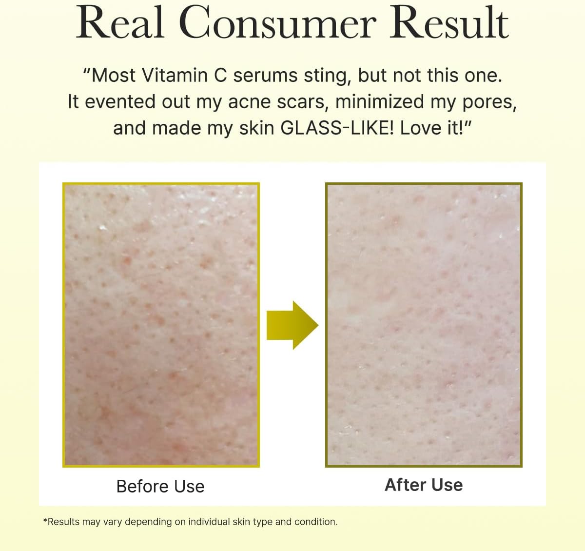 Before and after comparison of skin texture with text about a vitamin C serum's effectiveness.