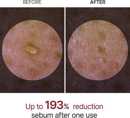 Dr. Melaxin - Peel Shot Glow White Rice Peeling Ampoule