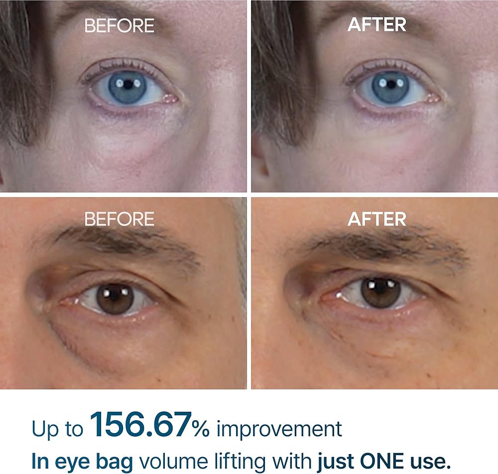 Dr. Melaxin - Eyephalt Eye Bag Cream