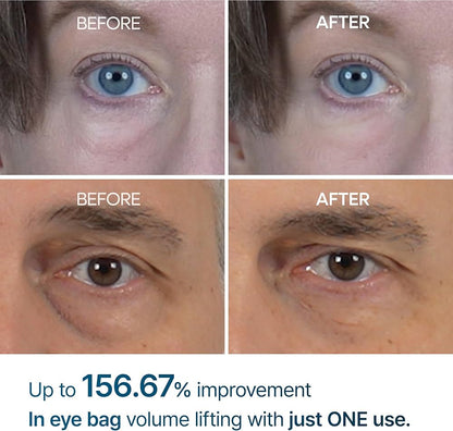 Dr. Melaxin - Eyephalt Eye Bag Cream