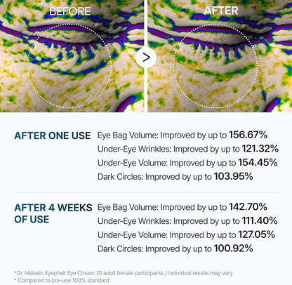 Dr. Melaxin - Eyephalt Eye Bag Cream