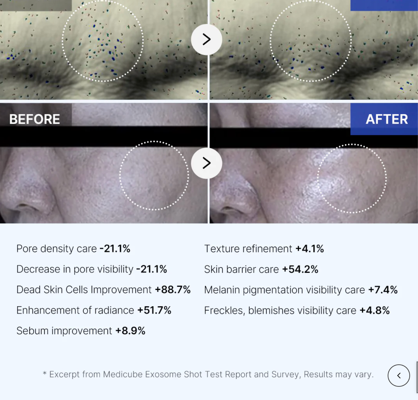 Before and after comparison of skin treatment with text detailing improvements.