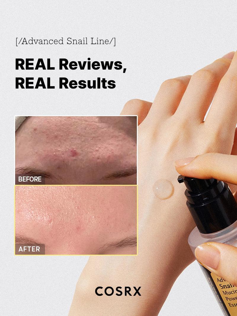 Cosrx skincare product with before and after skin comparison on a white background
