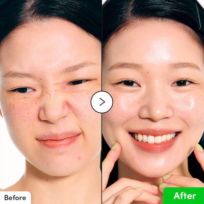 Eqqualberry - Aloe PDRN Calming Serum