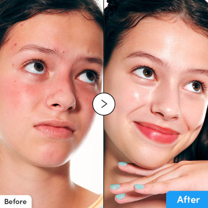 Before and after using eqqualberry blue serum