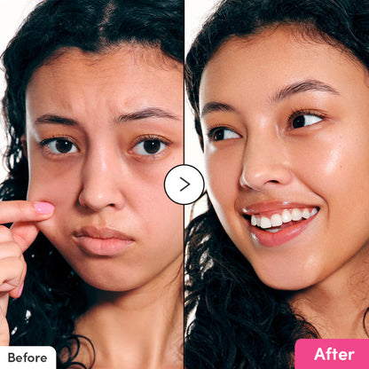 Before After using Eqqualberry NAD+ Peptide Booster Serum